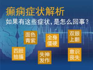 成都有哪些治疗原发性癫痫病的方法?